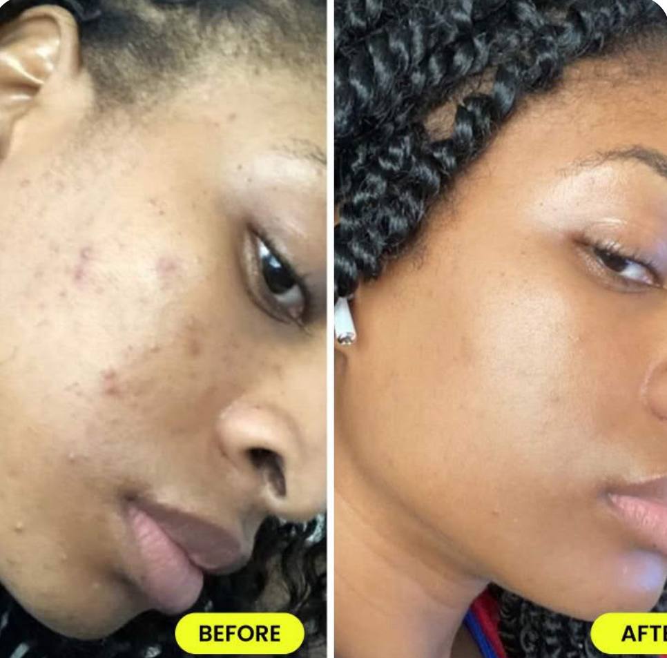 Duo Dr-Rashel Crème & Sérum Anti-tache & Ride