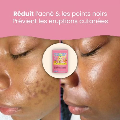 Pads Nettoyant Anti-Imperfections au Curcuma - 40 Cotons 🇬🇦