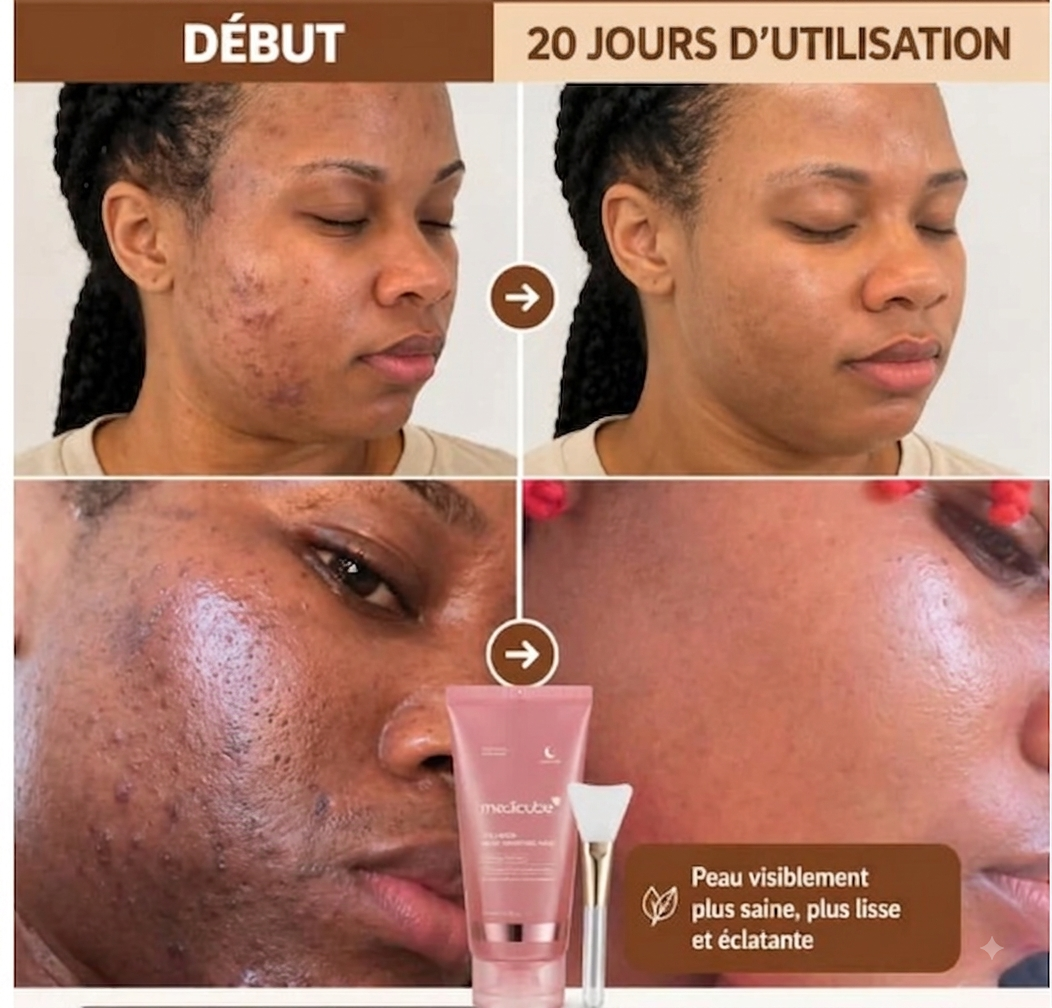 Masque de Visage au Collagène – Peau Lisse & Éclatante instantané au Réveil !