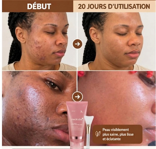 Masque de Visage au Collagène – Peau Lisse & Éclatante instantané au Réveil !