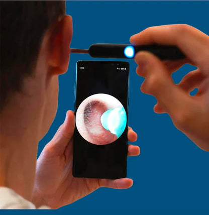 Kit d’élimination cérumen à caméra